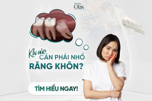 Khi nào cần nhổ răng khôn
