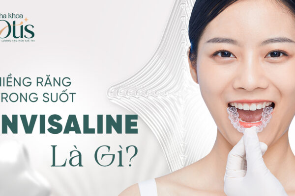Niềng răng invisalign