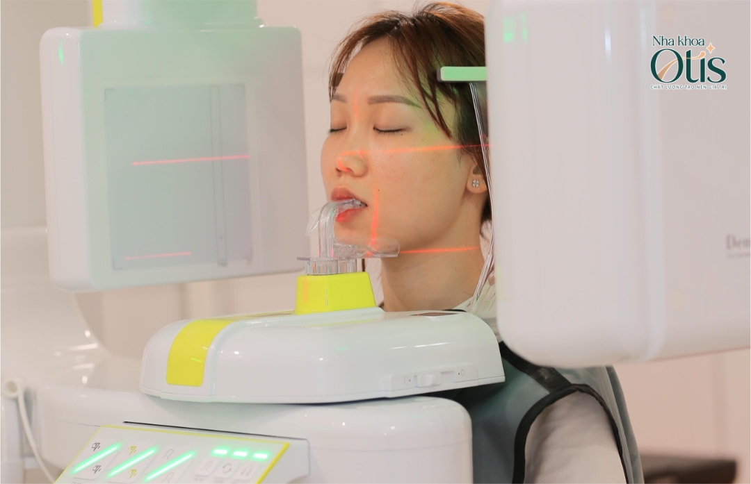 Tại nha khoa OTIS khách hàng được chụp phim CT 3D ConeBeam 
