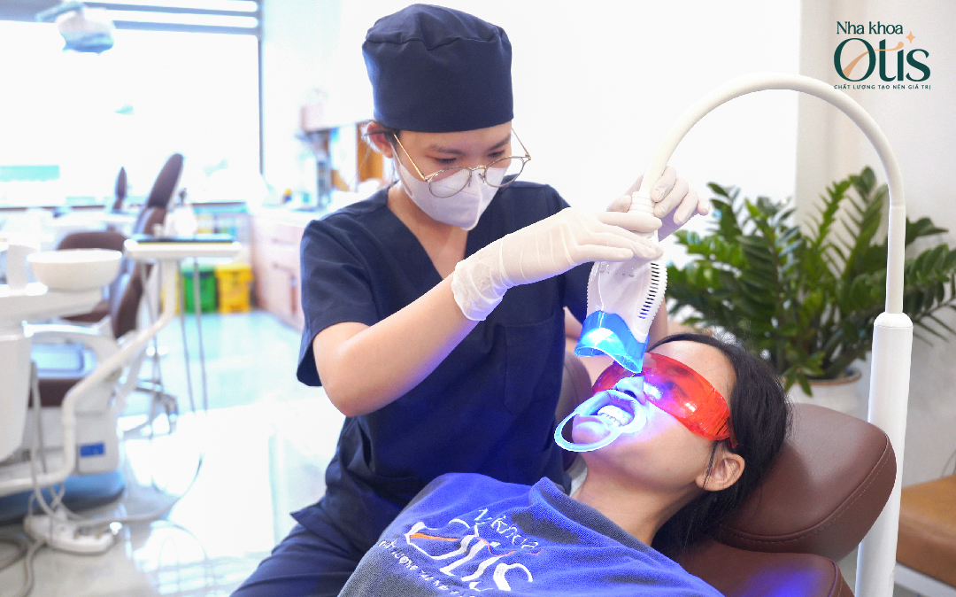 Tẩy răng răng diễn ra từ 60-90 phút