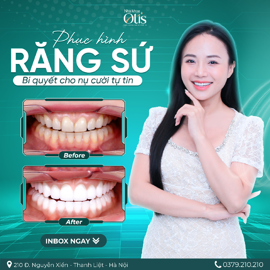 Nha khoa OTIS phục hình răng sứ uy tín
