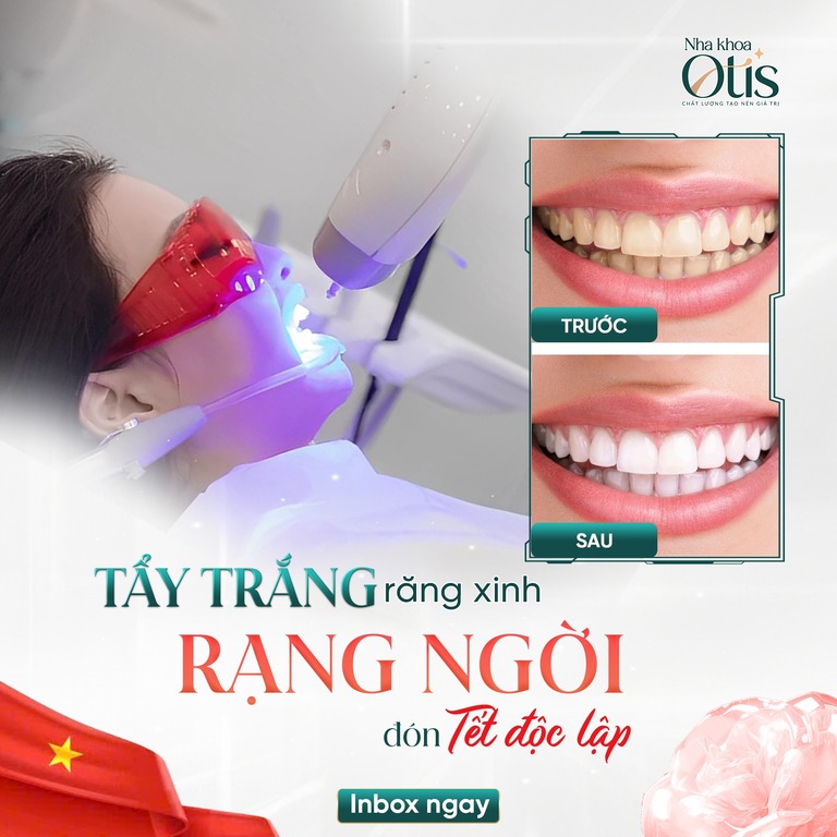 Tẩy trắng răng giúp răng trắng sáng lấy lại sự tự tin