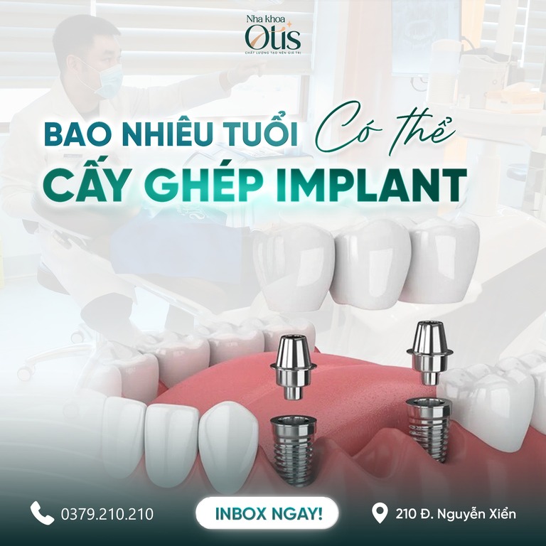 Bao nhiêu tuổi thì trồng răng Implant được