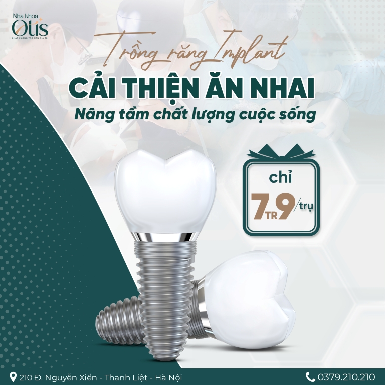 Lưu ý trồng implant răng hàm sớm