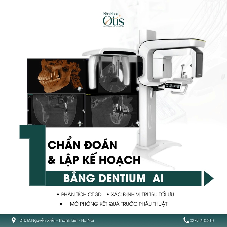 Trồng răng Implant bằng công nghệ hiện đại