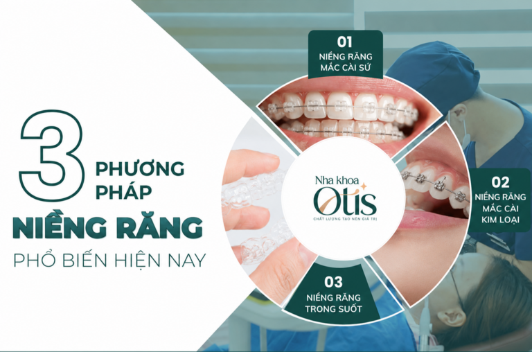 Niềng răng là phương pháp điều chỉnh khớp cắn và nắn chỉnh răng