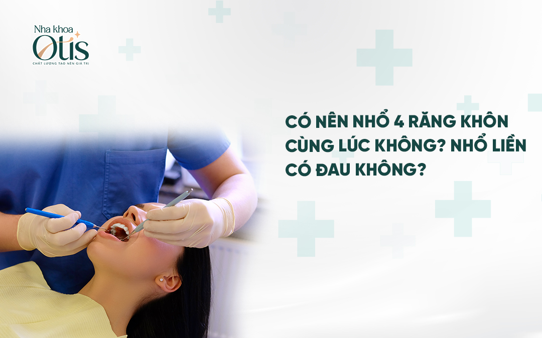 Có nên nhổ 4 răng khôn cùng lúc không