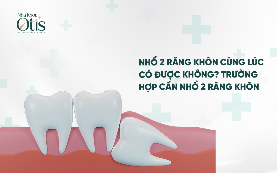 Nhổ 2 răng khôn cùng lúc có nhiều lợi ích