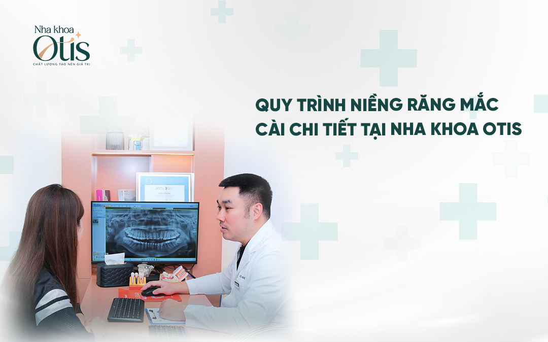 Quy trình niềng răng mắc cài gồm 5 bước