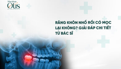 Răng khôn nhổ rồi có mọc lại không và cần lưu ý điều gì