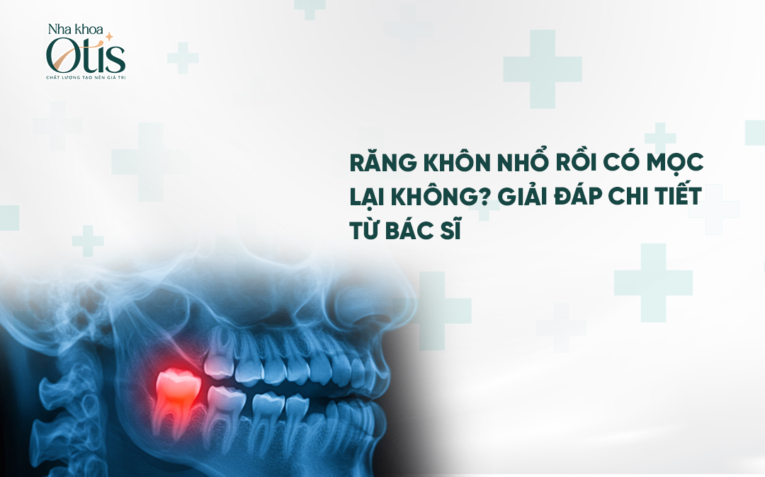 Răng khôn nhổ rồi có mọc lại không và cần lưu ý điều gì