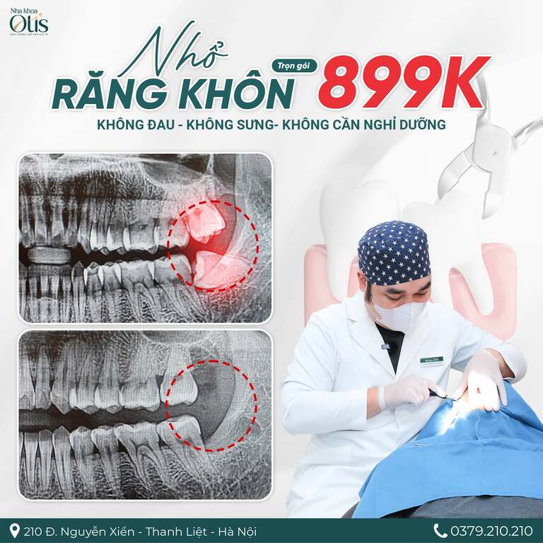 Răng khôn nhổ rồi có mọc lại không 