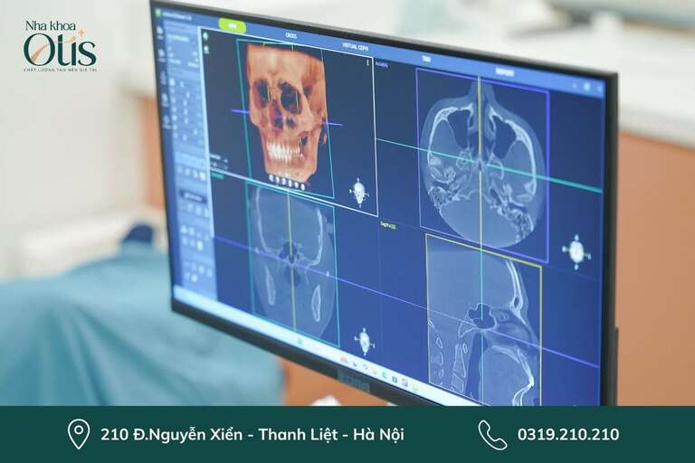 Thăm khám và chụp phim là bước đầu trong quy trình niềng răng mắc cài