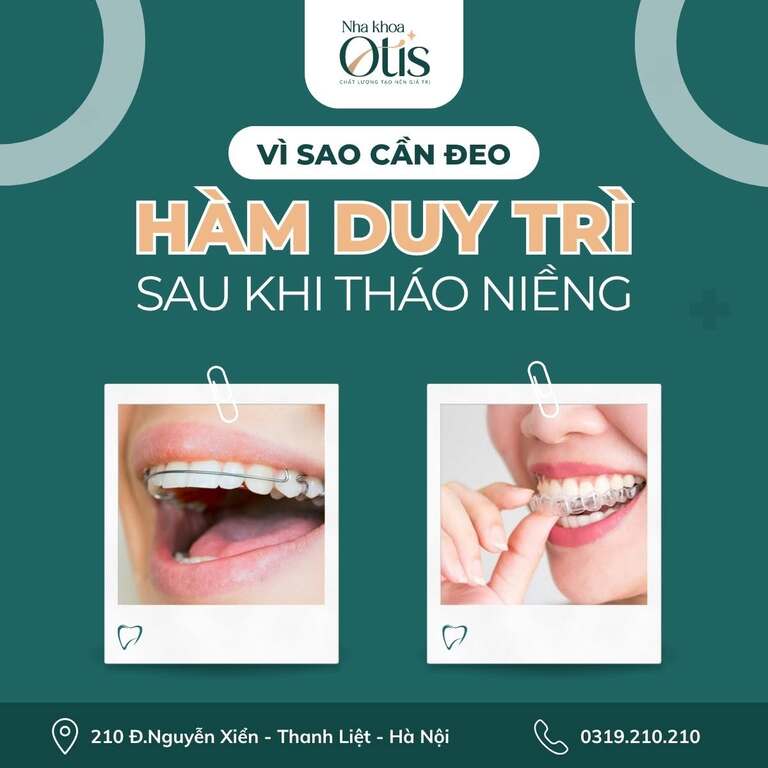 Lưu ý đeo hàm duy trì sau niềng răng