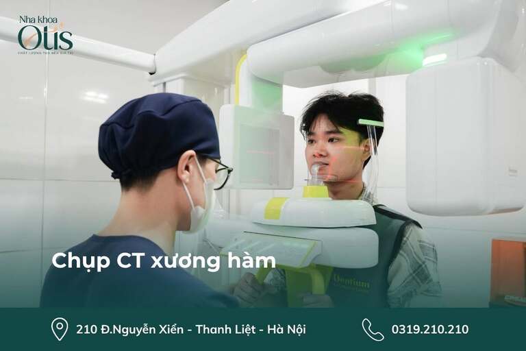 Chụp phim CT là 1 trong những điều cần biết về niềng răng