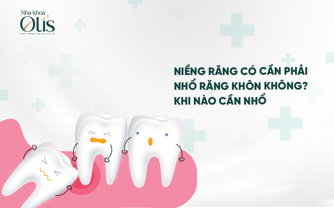 Khi nào niềng răng cần nhổ răng khôn