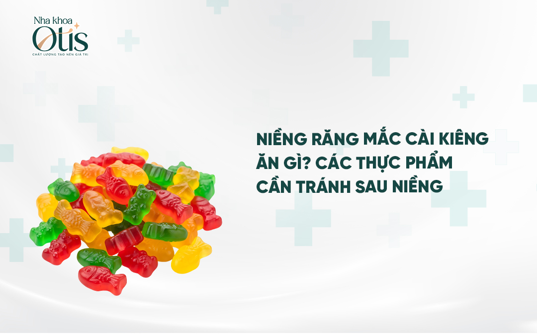 Niềng răng nên kiêng ăn gì?