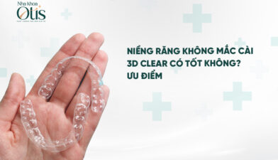 Tìm hiểu về loại niềng răng không mắc cài 3D Clear