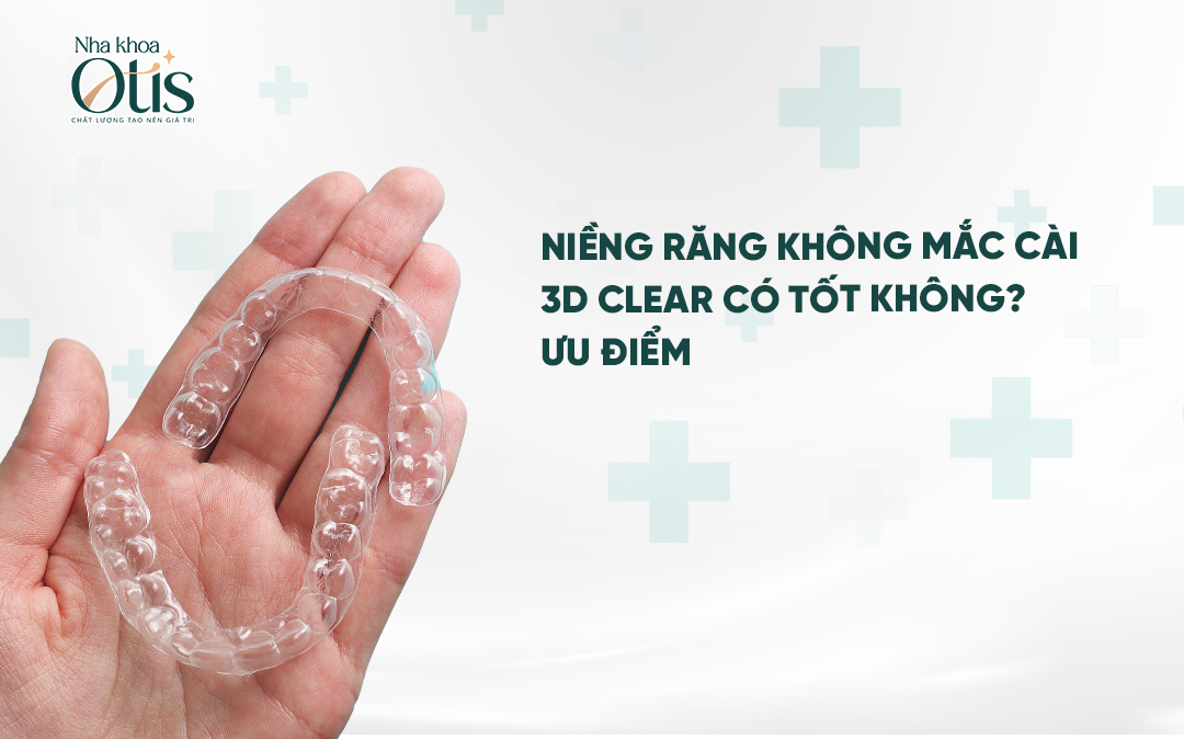 Tìm hiểu về loại niềng răng không mắc cài 3D Clear