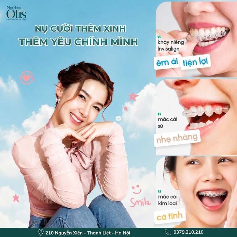 Lựa chọn phương pháp niềng răng theo thời gian dự kiến
