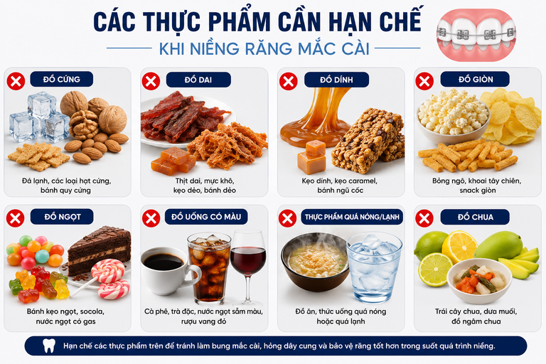 Lưu ý các thực phẩm cần hạn chế khi niềng răng